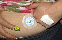 Laastaroidut k�det ja lappu